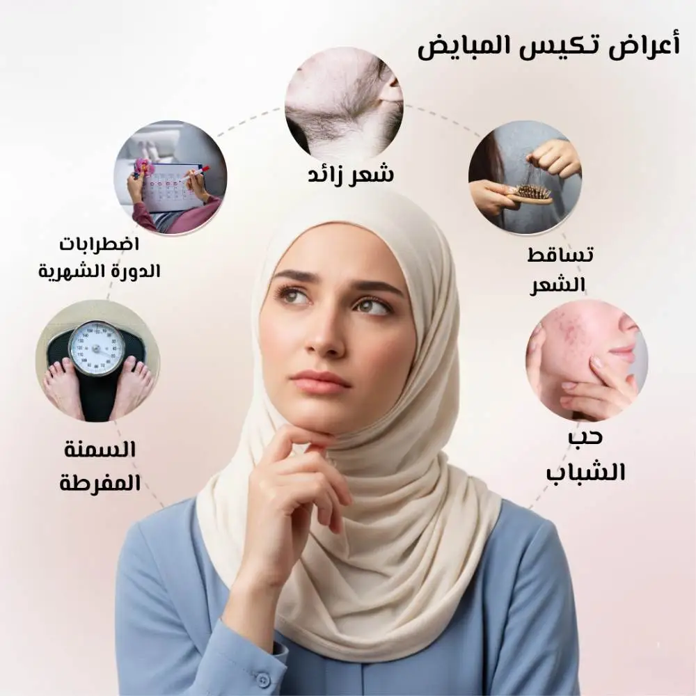 كيف أعرف أني أعاني من تكيس المبايض؟